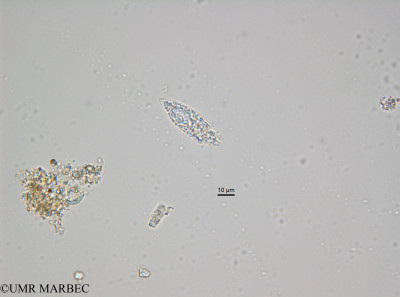 phyto/Bizerte/bizerte_bay/RISCO November 2015/Oxytoxum sp10 (BaieT5_CW3_Oxytoxum_lequel170228_001_ovl-10).tif(copy)_thumb.jpg